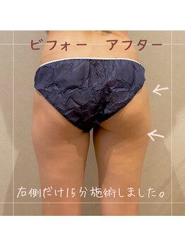 ザ シティ 札幌店(The CITY)/