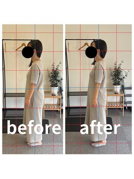 熊本カワル整体 JR上熊本駅院/姿勢改善