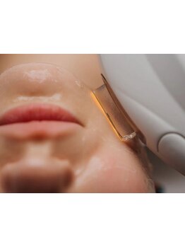 顔脱毛がしたい