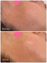 ククル(KUKULU)/ハーブ13回目♪(40代女性)