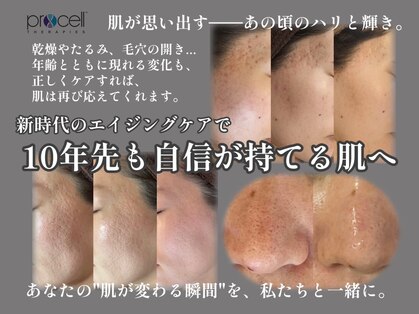 リードスラッシュ(LEAD/)の写真