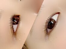 シクラプ(siklap)/