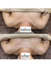 リラ 郡山店(Lilas)/巻き肩ケアから美姿勢を目指す！