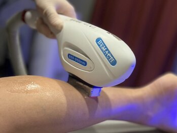 アデル 久留米(ADEL)の写真/《次の夏に向けて》面倒な自己処理を軽減＊痛みを最小限に抑えた最新マシンで痛みが苦手な方にもおすすめ♪