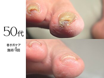 フットケア クラッシー(footcare classy)の写真/男性のお客様多数!完全個室でリラックス◎ケアサロン初心者も大歓迎!