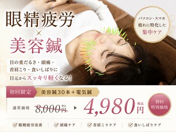 メモラ(memola)の写真/【脱！眼精疲労】目の疲れで世界が変わる◎ぱっちり目&小顔に《美容鍼/眼精疲労/小顔》