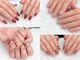 アレゴ ネイル(Allergo nail)の写真
