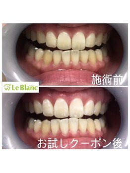 ルブラン 奈良店(Le Blanc)/高い施術効果!!