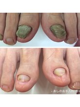 フットファースト 小田原大井町店/ ビフォアアフター