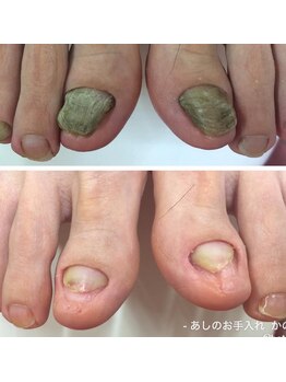 フットファースト 小田原大井町店/ ビフォアアフター