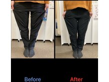 ごうだ整骨院/О脚矯正