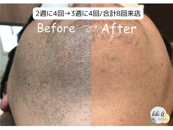 ビビユー(bibi u)