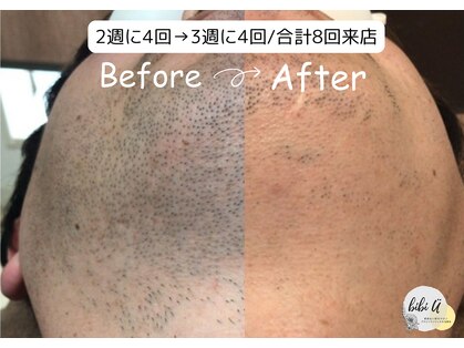 ビビユー(bibi u)の写真