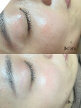 クロシェ/美肌を作るフェイスWax