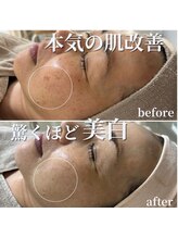 セリー(Celie)/お客様症例