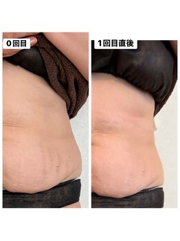 リアリア(LEALEA)/レモンボトル×ノアグロウ