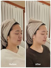 アン 銀座(ann)/横顔スッキリ