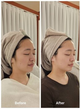 アン 銀座(ann)/横顔スッキリ