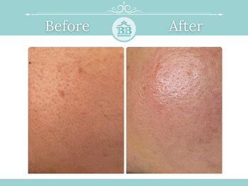 ゼロ美人 那覇店(ZERO美人)/【シミケア☆シミケアZERO美人】