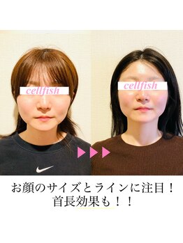 セルフィッシュ(Cellfish)/小顔&全身矯正(ブライダル)