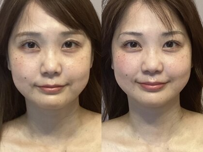 アイビー 二子玉川店(IB)の写真