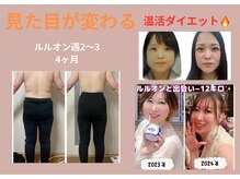 ヨサパーク ハナ 六甲道(YOSA PARK HANA)