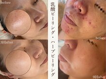サロンドペシェ(salon de peche)
