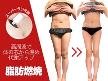 セルライト専門店【癒しゼロの熱血エステ】FEMBE錦糸町店【7/1　NEW OPEN（予定）】の雰囲気（【ボディメイク】体重より見た目を整え、引き締まった華奢な体に）