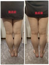 エスポワール(Espoir)/フットマッサージ