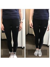 ごうだ整骨院/О脚矯正