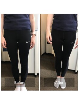 ごうだ整骨院/О脚矯正