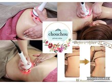 シュシュ(chouchou)