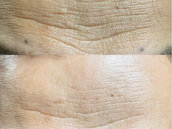 リシア(RECIA)/本当に必要なおうち美容をお伝え