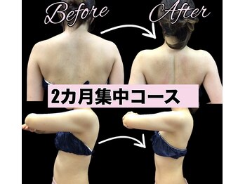 スワン 新栄店(SWAN)/2カ月集中モニター