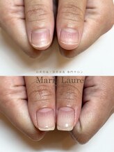 マリーロール 淀屋橋本店(Marie Laure)/自爪育成/深爪矯正/ネイルケア