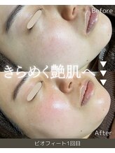 ザ プレザント 大倉山(the pleasant)/クリスティーナのビオフィート