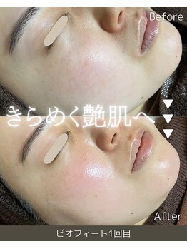 ザ プレザント 大倉山(the pleasant)/クリスティーナのビオフィート