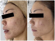 シャルム(Charme)