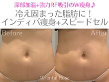 オリエンタルローザ 表参道(Oriental Rosa)/お腹インディバ痩身で理想Body♪