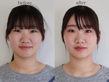 シロイロ(SHIROIRO)/