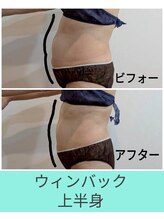 エミナル(EMINAL)/60分のウィンバック効果　お腹
