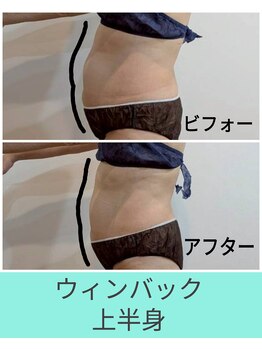 エミナル(EMINAL)/60分のウィンバック効果 お腹