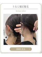 ミース 上野店/上野でうなじ矯正♪