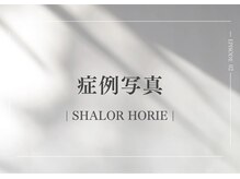 シャロル(SHALOR)/クリスティーナ｜症例写真