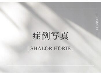 シャロル(SHALOR)/クリスティーナ|症例写真