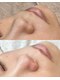 メメビューティー アンド ワキシング(meme beauty&waxing)の写真/【毛穴エクストラクションプロ】毛穴美人コース90分