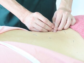 明大前はり灸院/優しい鍼刺激は初めての方にも◎