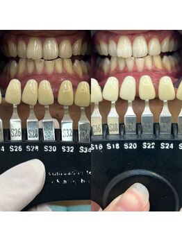 トウキョウスワーズ 池袋店(TOKYO SWRS)/#ホワイトニング #池袋 #渋谷