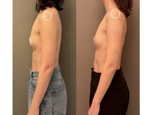 リリ(RiRi)の雰囲気（マシン施術全てに巻き肩改善付きで女子力アップ♪）