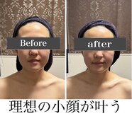 小顔アンドエイジングケア専門店 ビゼ(美sser)